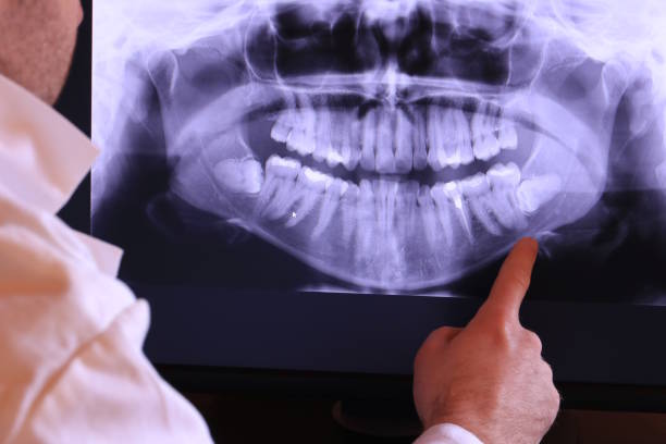 Best Dentist for Tooth Abscess  in Hazel Green, AL